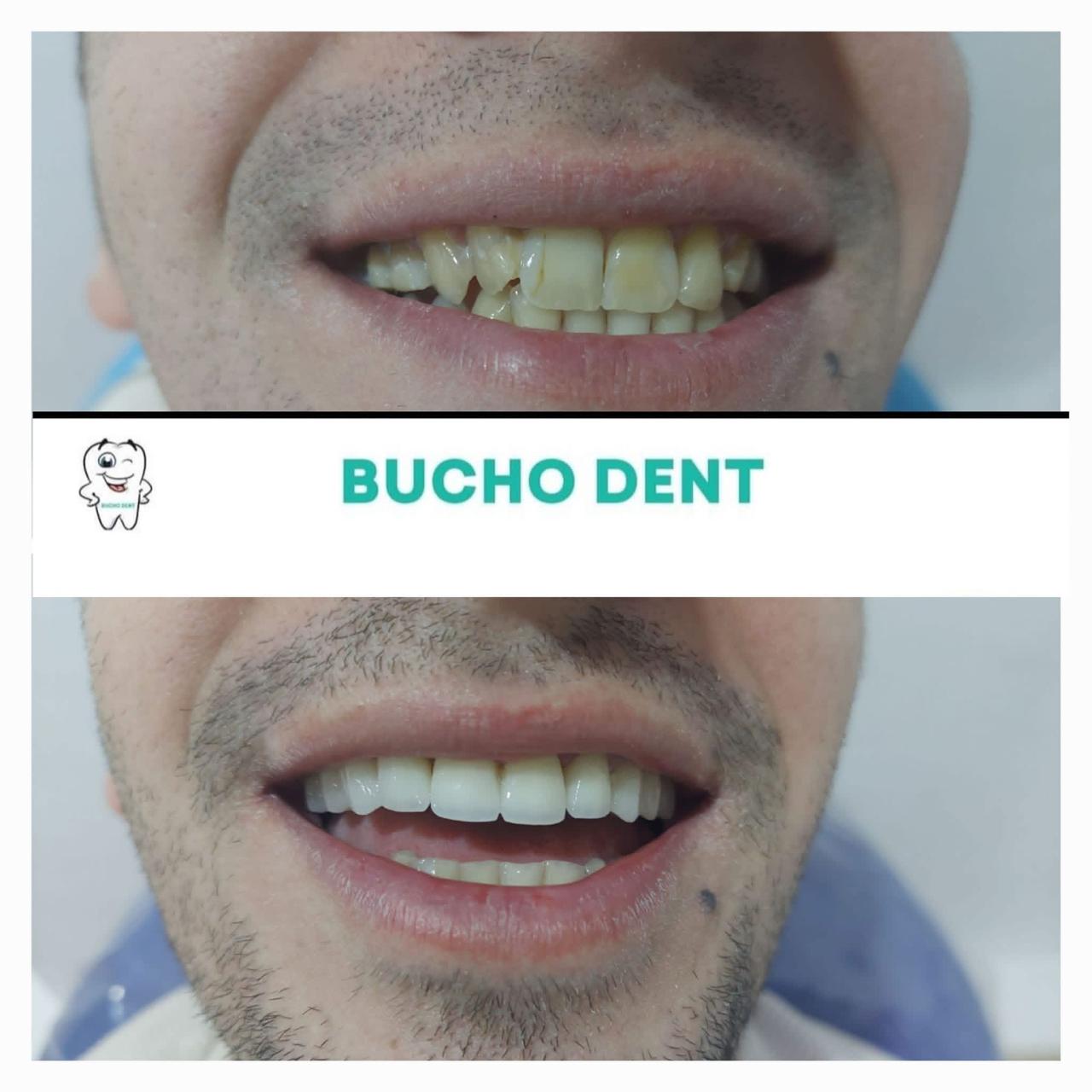Dental Work