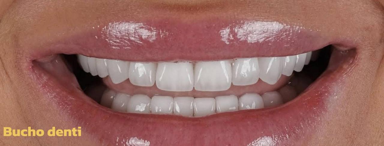 Dental Work