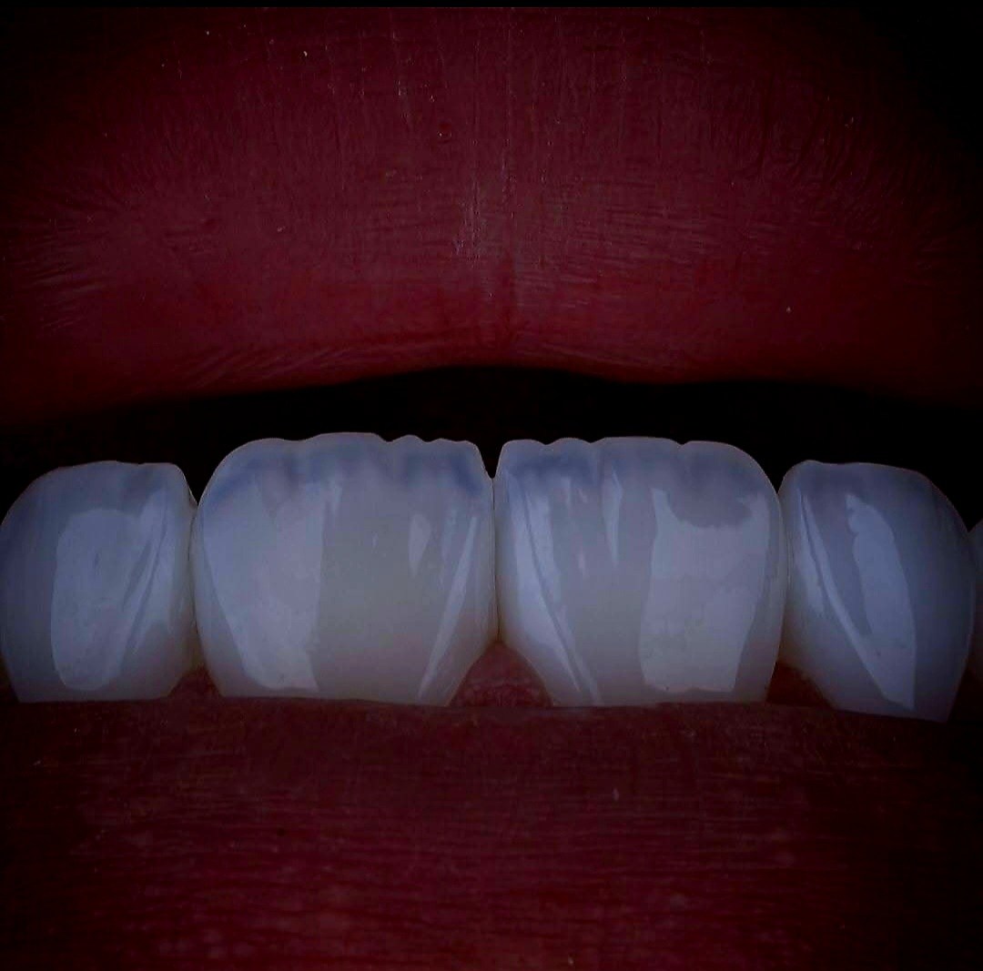 Dental Work