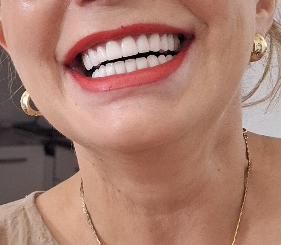 Dental Work