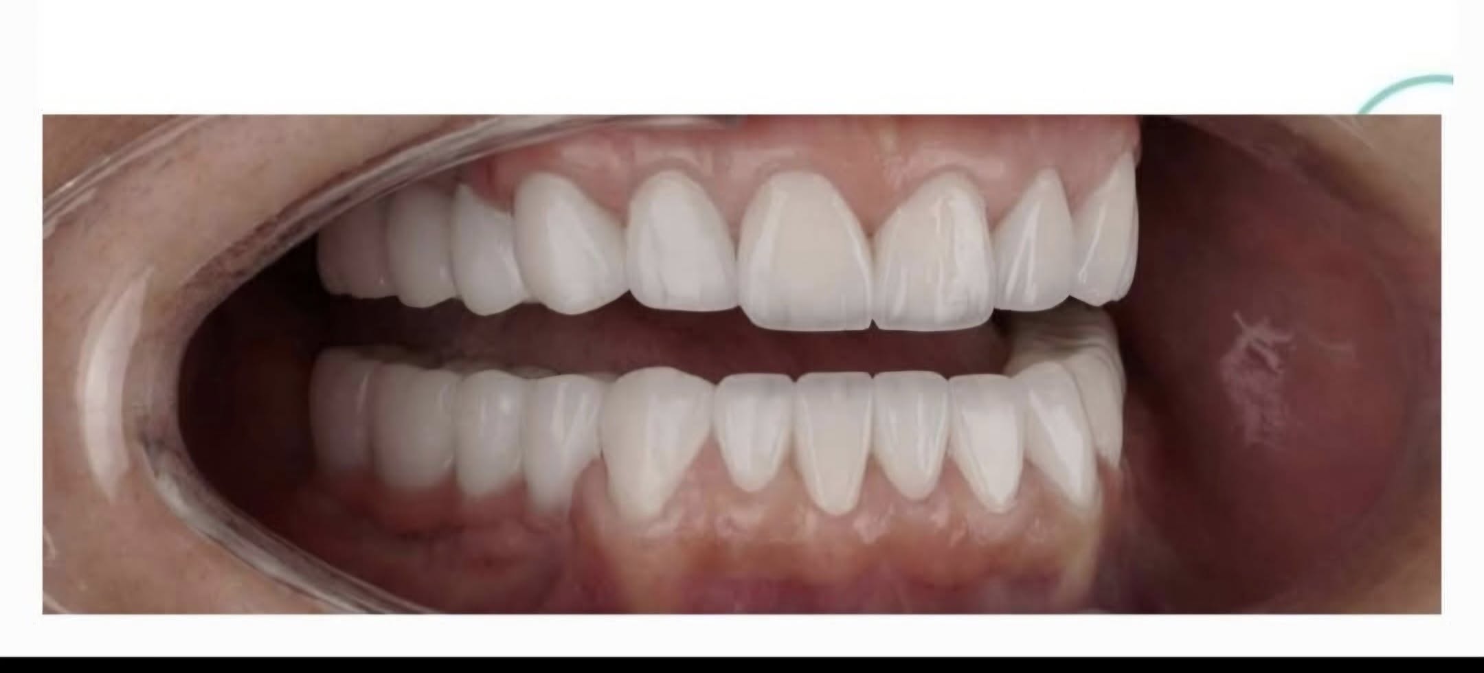 Dental Work