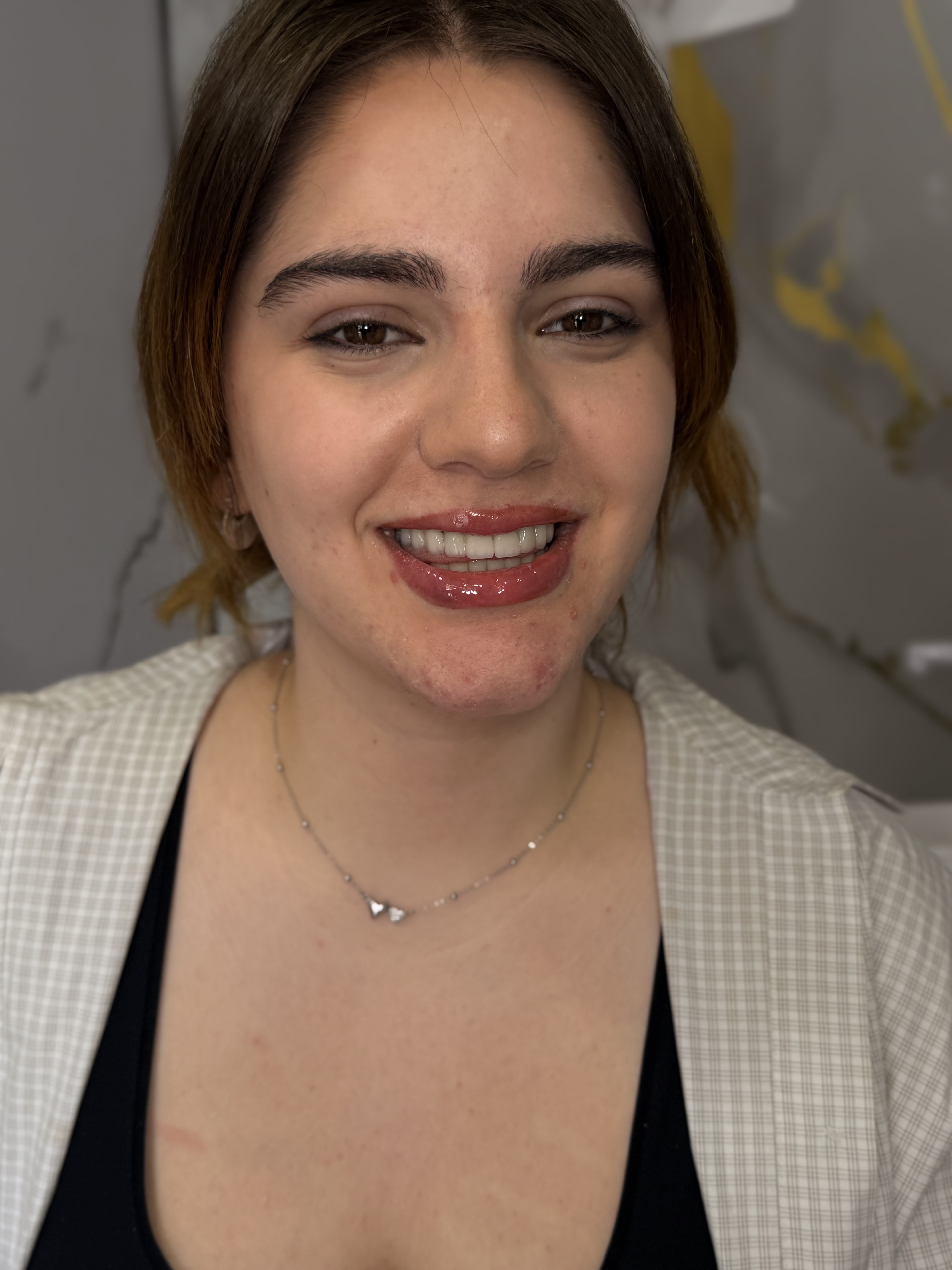     Why International Patients Choose Georgia for Dental Treatment in 2026