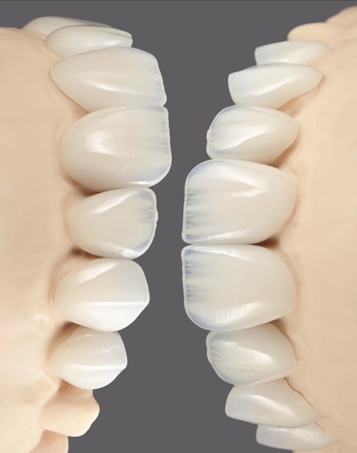   How International Patients Prepare for Dental Treatment in Georgia | BuchoDenti