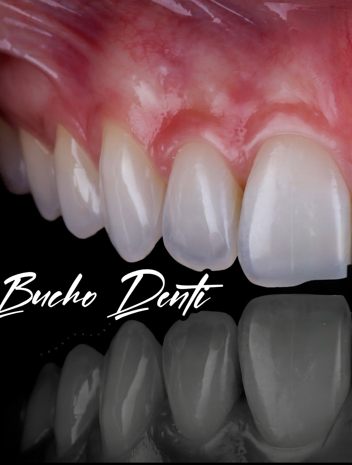 Dental Implants in Georgia: The Complete Guide for UK & Israel Patients (2026)