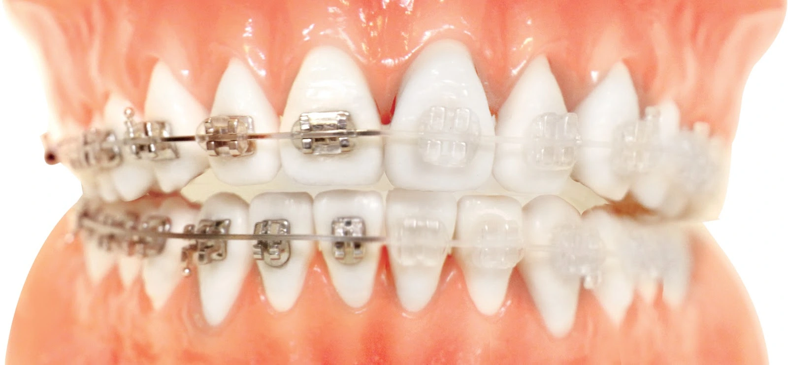 ორთოდონტია - Dental Service Tbilisi