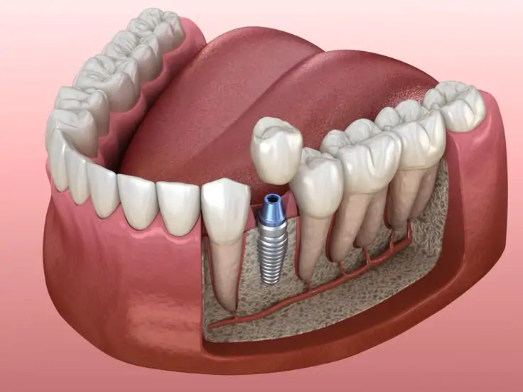 თერაპია და ქირურგია - Dental Service Tbilisi